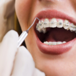 best dentist in Liverpool