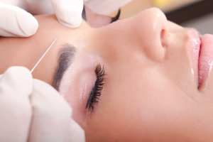 2 Benefits of Getting Botox