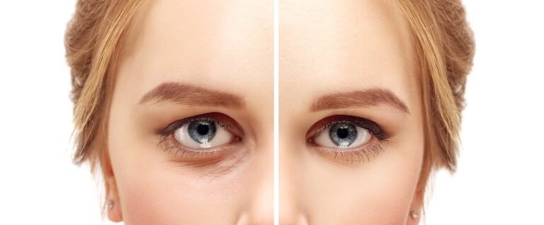 4 Factors That Make You Look Older