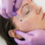 5 Quick Facts To Keep In Mind About The Ever-Popular Vampire Facial!