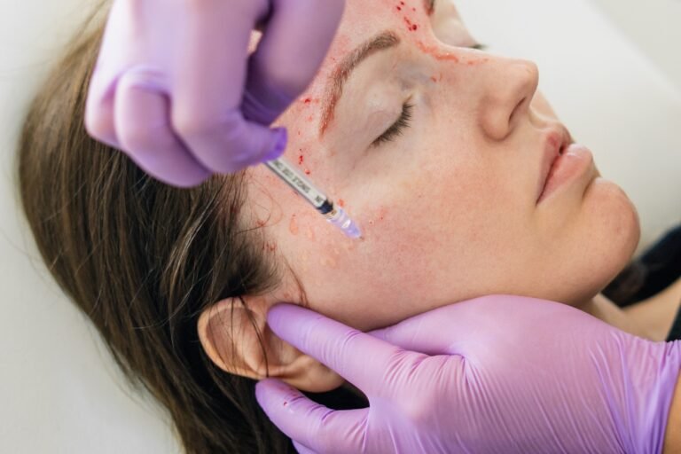5 Quick Facts To Keep In Mind About The Ever-Popular Vampire Facial!