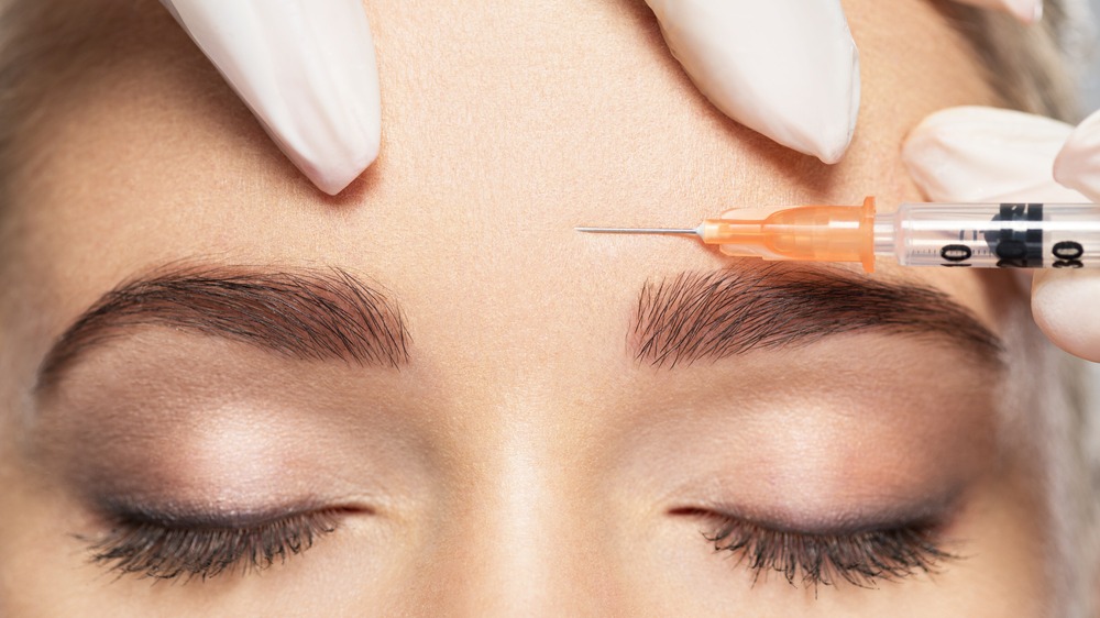 Everything You Need to Know Before You Try Botox for the First Time